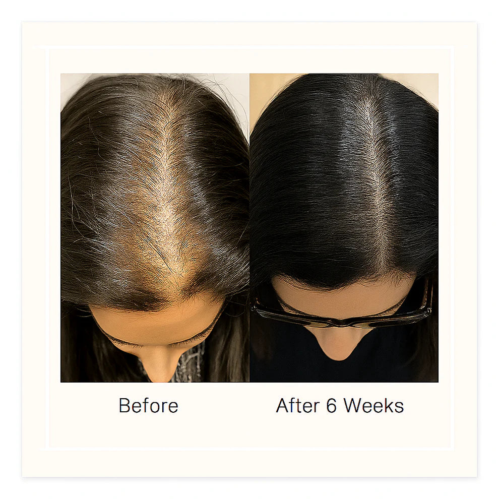 Vitala Advanced Hair Growth Roll-On Serum 2