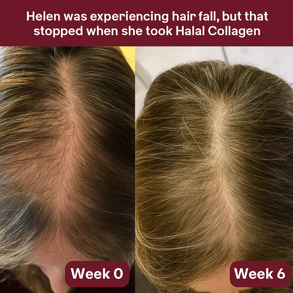 Vitala© Multi Collagen Peptides