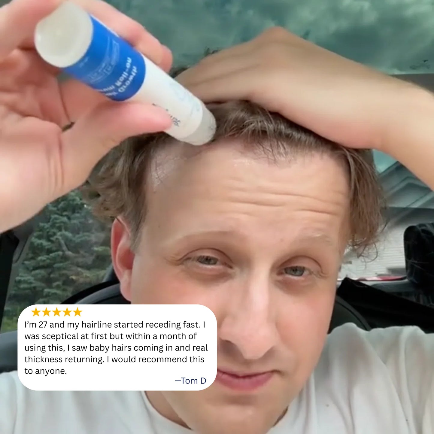 Vitala Advanced Hair Growth Roll-On Serum 2